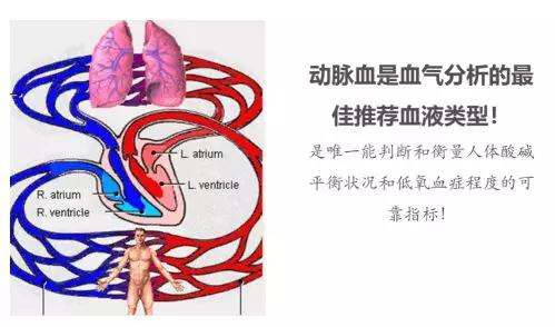 血气仪市场规模,血气分析仪市场报价