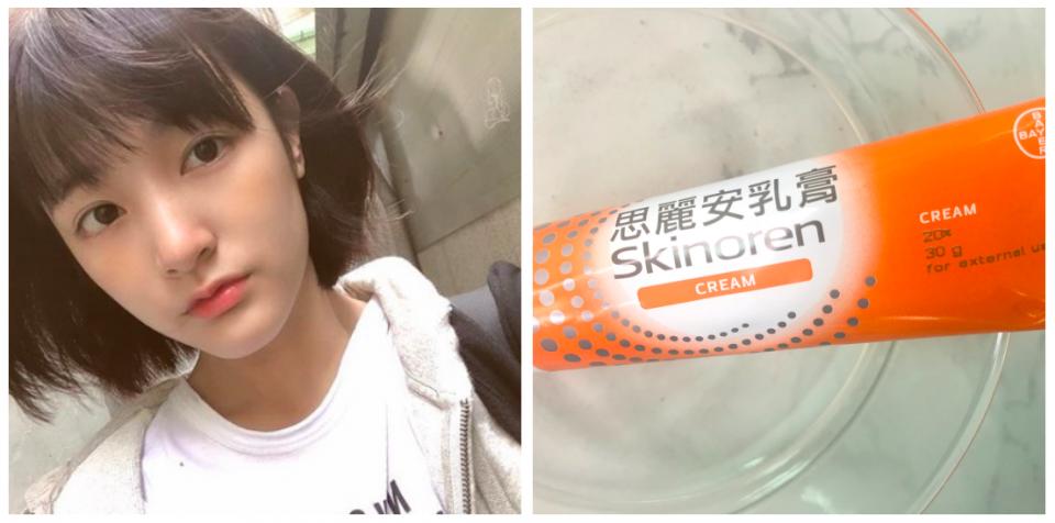 女明星分享3款药品等级的药膏、药水，紧急舒缓皮肤不适、止痒