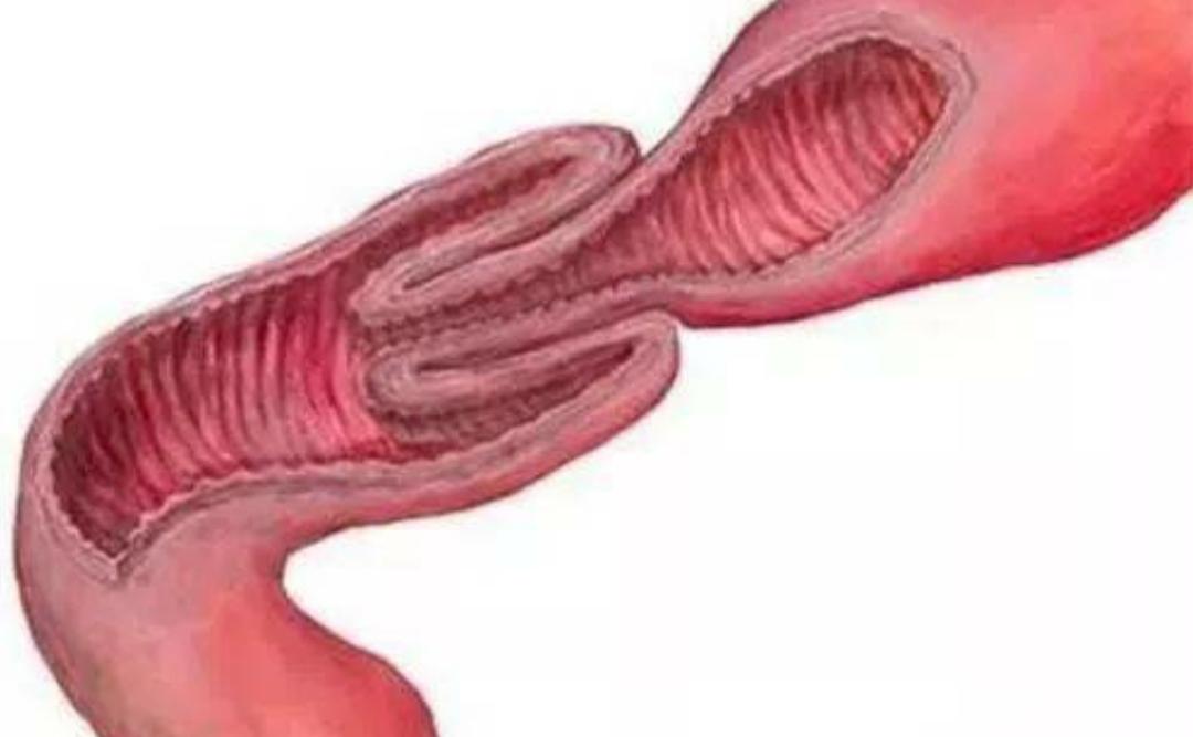 宠物细小病毒好了还吐是肠套叠,狗狗细小病毒不会流口水吧