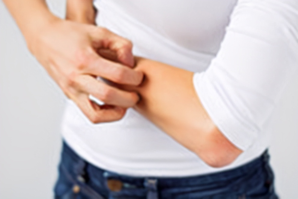 皮肤对化学品过敏用什么药,皮肤化学品过敏怎么办