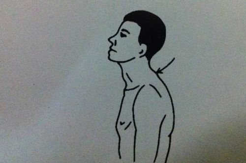 有谁知道颈椎病怎样练习治愈,有轻微的颈椎病怎么理疗