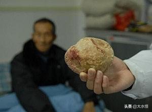 三十五年前猪肉价格是多少钱一斤,猪肉历史最高价格多少钱一斤