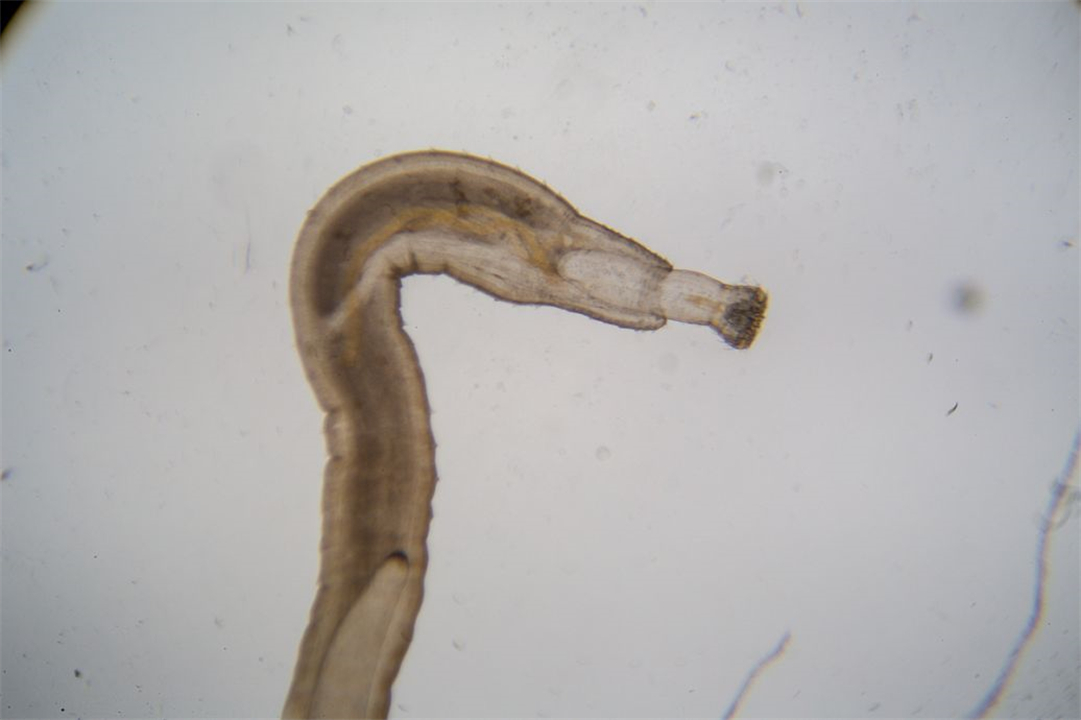 水蛭被人吃进肚子里它能活多久,水蛭误吃进肚子里怎么办