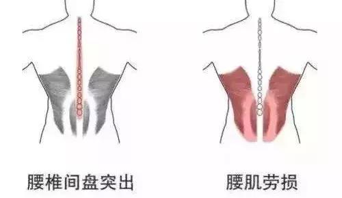 人未老腿先衰的后果,人未老身体已先衰