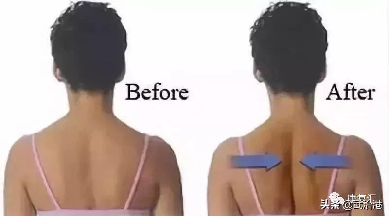 高低肩怎么自我矫正学会这几招,高低肩怎么自我矫正健身