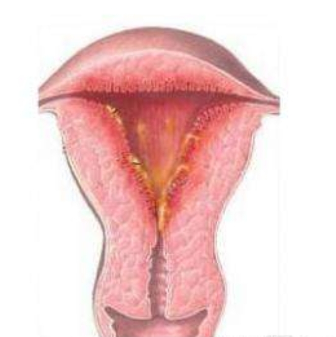 感染反复,感染一直治愈不了是为什么