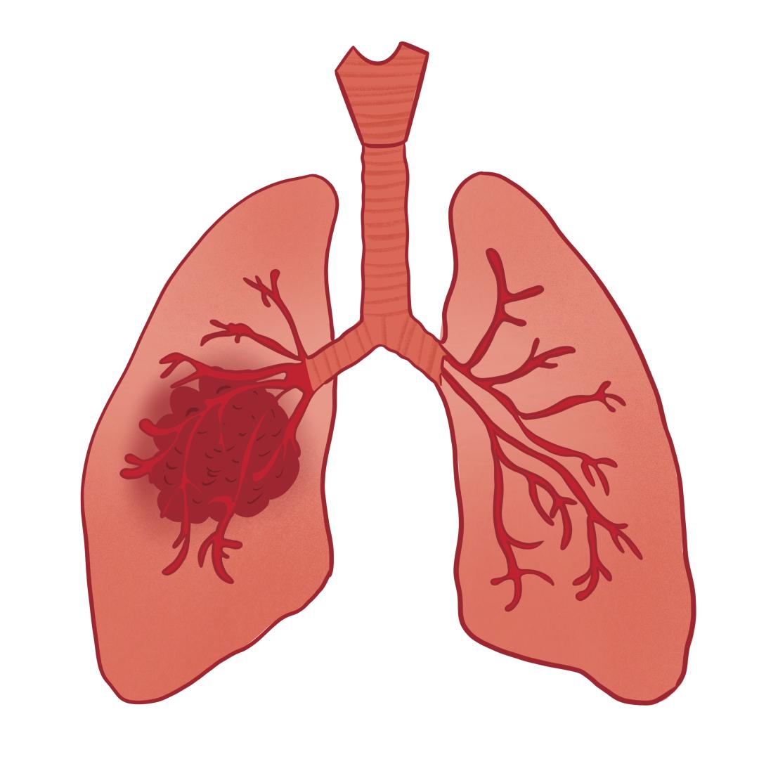 体检不花冤枉钱检查哪些项目,体检怎么样才能不花冤枉钱