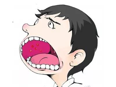 宝宝溃疡是缺什么吗,一岁半宝宝上火嘴里溃疡怎么办