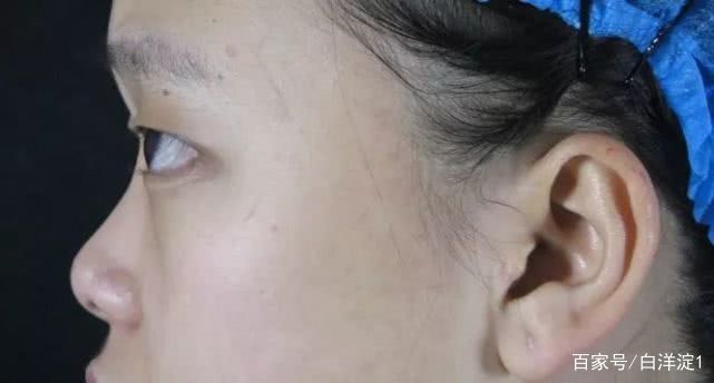 名门泽佳的正确涂法,名门泽佳祛皱小细节