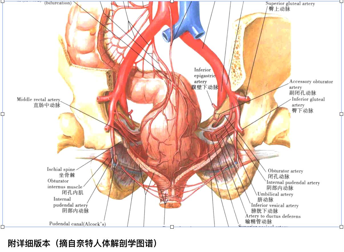 骨盆骨折动脉破裂介入治疗,骨盆骨折髂内动脉栓塞