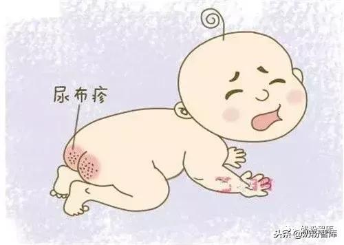 宝宝红屁股如何预防及处理,怎么预防宝宝红屁股的方法