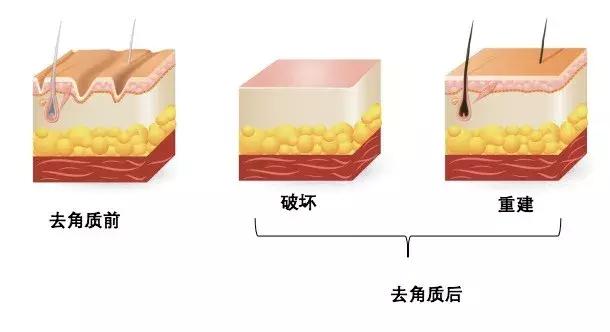 角质层怎么用视频教程,角质层薄怎么涂护肤品