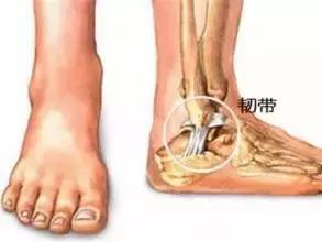 崴脚了是冰敷还是热敷,跑步崴脚了冰敷还是热敷