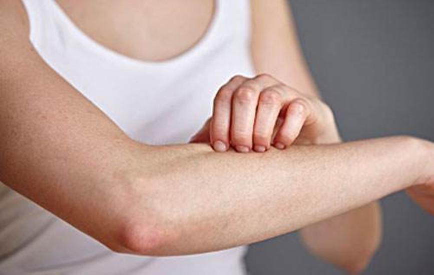 皮肤瘙痒7个止痒中成药,皮肤瘙痒大家有什么好的偏方吗