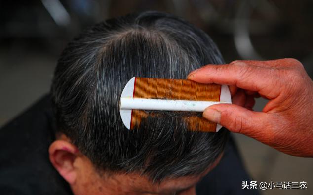 农村人现在还长虱子吗,为什么以前农村的虱子现在少见了