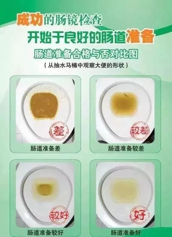 带您了解全结肠镜检查,内镜专家为您揭秘肠镜检查不可怕