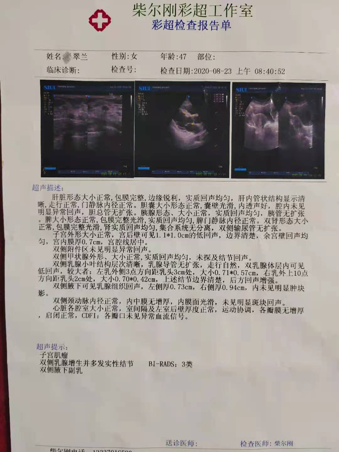 中药可以治乳腺囊性结节,中药治疗乳腺结节与肺结节