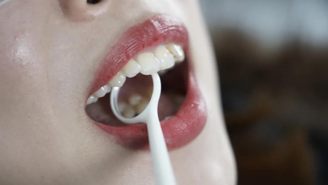 根管治疗是不是就是杀死神经,根管第一次封药是杀神经吗