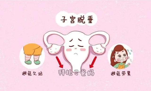 56岁子宫脱垂并伴有出血症状,孕期子宫脱垂的症状及危害