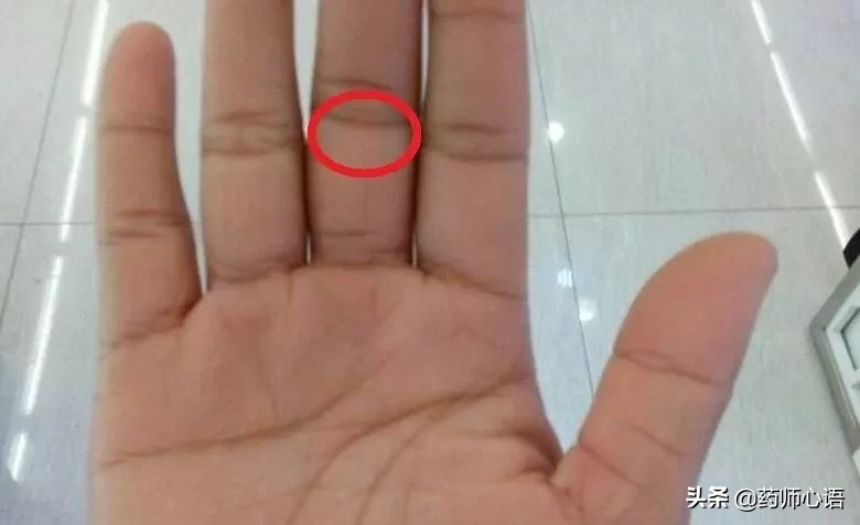 手上的健康秘密,手的颜色能看出健康的问题吗