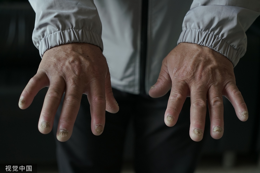 刘忠林离婚官司视频,刘忠林打官司