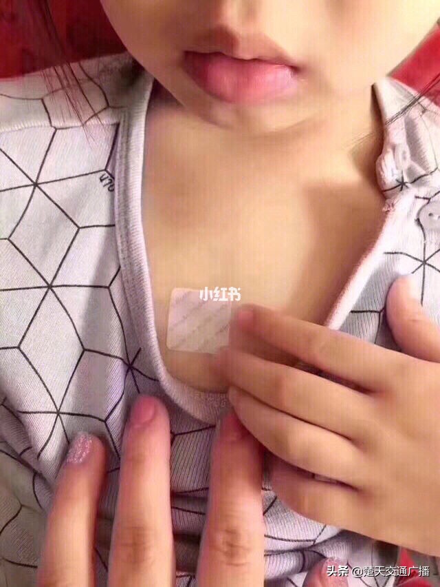 止咳贴副作用,效果很好的止咳贴药膏推荐