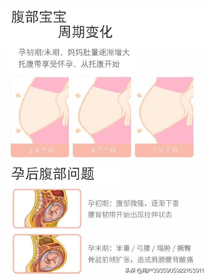 无痛分娩之后腰痛是后遗症吗,无痛分娩以后腰痛是怎么回事