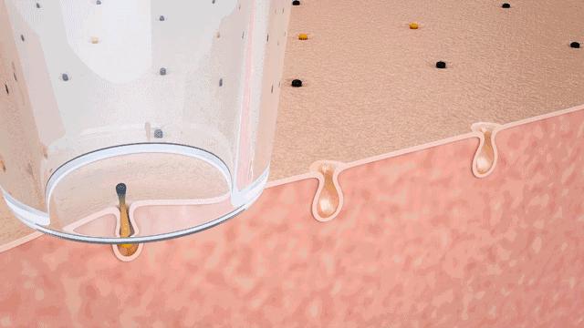 牙膏去黑头的方法靠谱吗,牙膏去黑头的正确方法