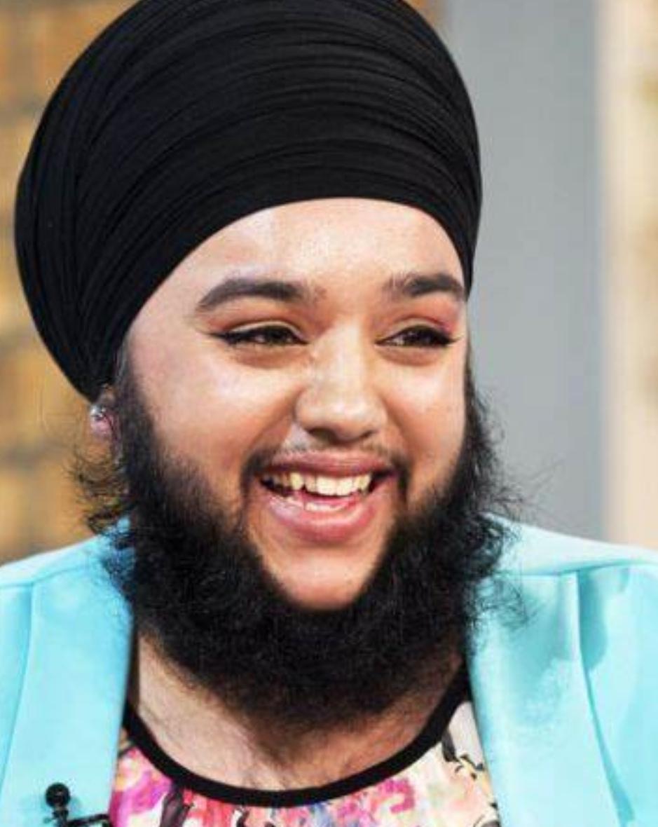 意大利女子牙龈长出睫毛状毛发，历经8年未治愈，病因很常见