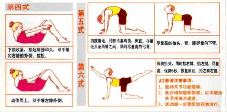 强直性脊柱炎需要哪些锻炼方法,强直性脊柱炎有哪些锻炼的方法