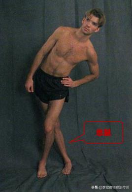 老生常谈跑步膝：髂胫束综合征（ITBS）