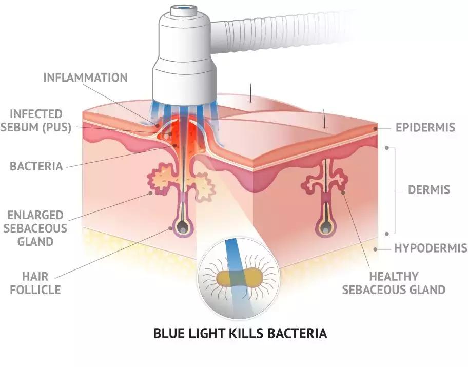 当医生问病人怎么打算时该怎么回,疮疡病病人的症状