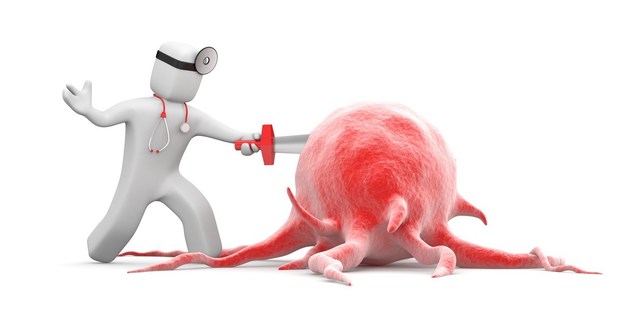 乳腺癌表面征象,乳腺癌早期胸部会有3个提示