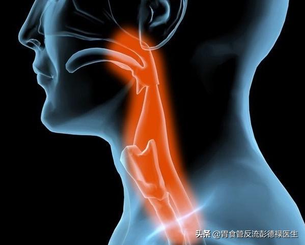 清嗓子声音嘶哑吞咽疼,喉咙有异物感做胃镜看得出来吗
