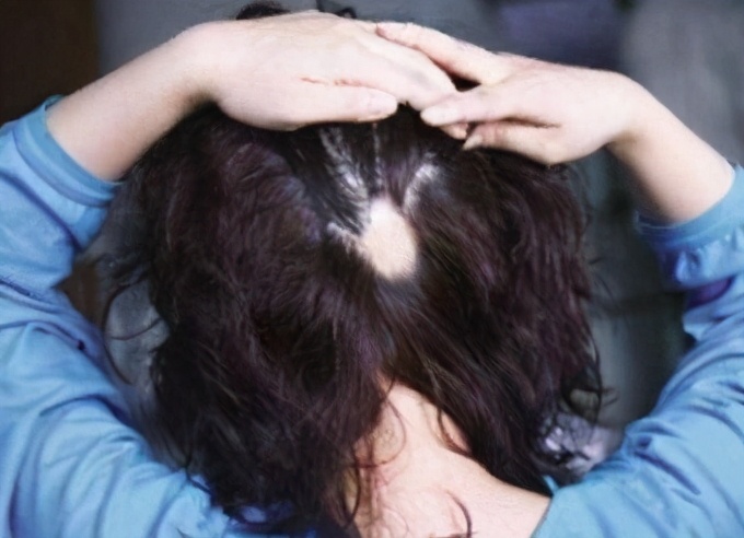 去屑止痒不伤头皮最好的洗发水,赫钻去屑控油头皮调理洗发水