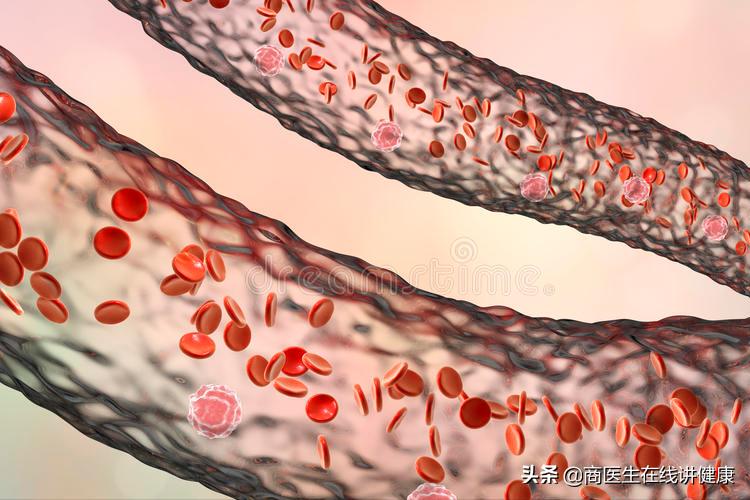 体检血肌酐高到100-300的肾病患者，会有什么后果？