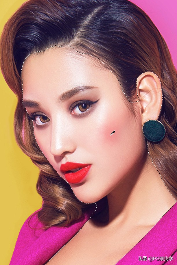 消除高原红,消除脸部高原红