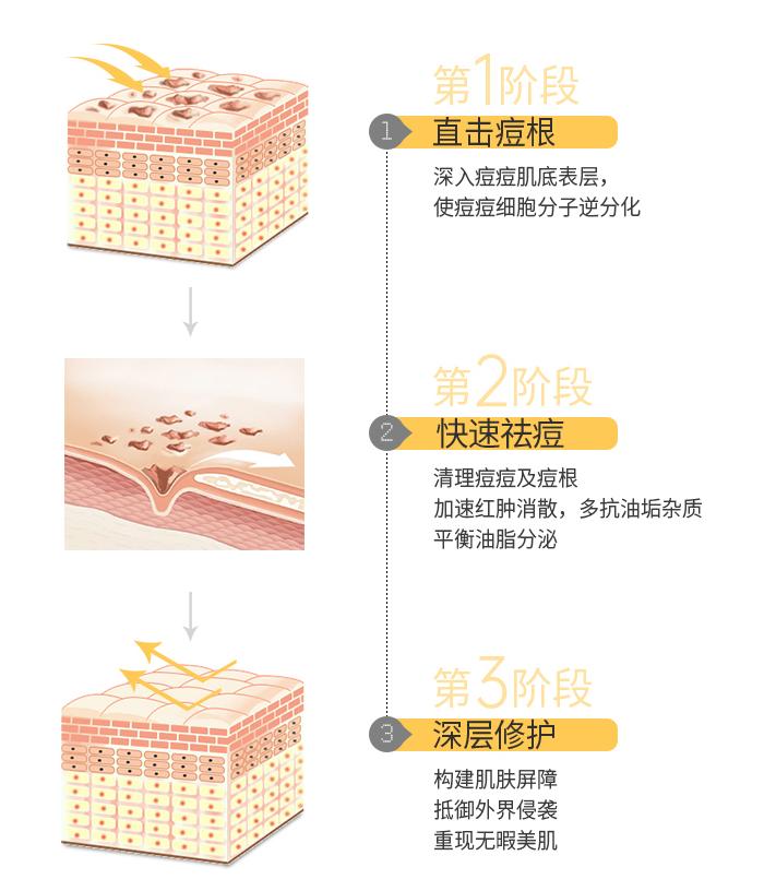 xdg水乳控油祛痘真实测评,水杨酸抗痘无痕精华液