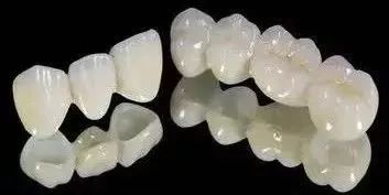 全瓷牙冠在保质期可以免费重做吗,全瓷牙冠价格表2021款报价