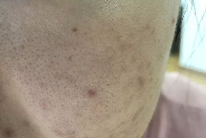 ysl閾惰壊姘斿灚10鍙峰拰20鍙峰姣旀潕浣崇惁,鏉庝匠鐞︾洿鎾棿blankme姘斿灚鑹插彿