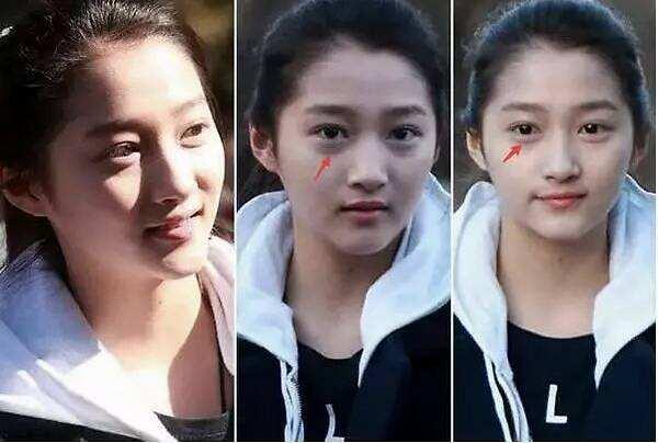 卧蚕和眼袋的区别你知道吗,眼袋和卧蚕的区别在哪里