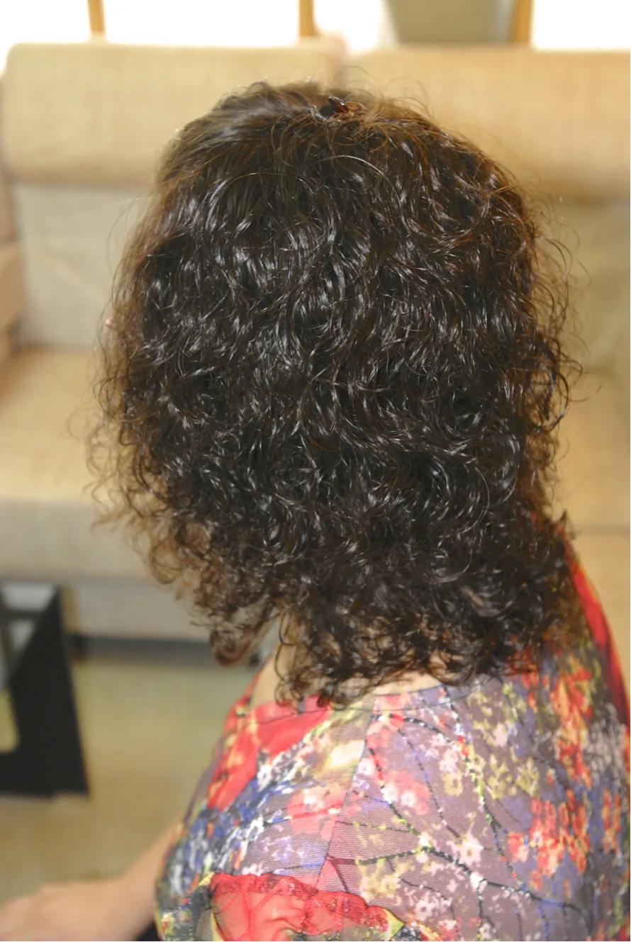 脱发到底该怎么应对,女脱发严重怎么解决