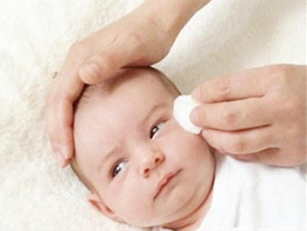 宝宝眼屎多警惕新生儿泪囊炎,儿科医生宝宝眼睛有眼屎