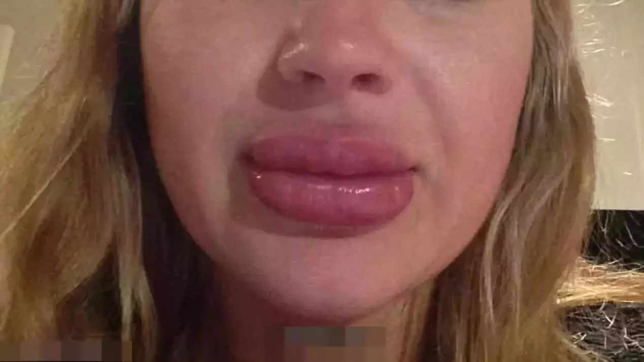 网红花5万赴日本“洗血”：这些自杀式美容法真是医美黑科技？