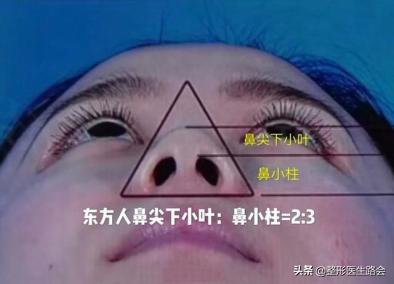 鼻翼缩小外切好吗,鼻翼缩小外切还是内切效果好