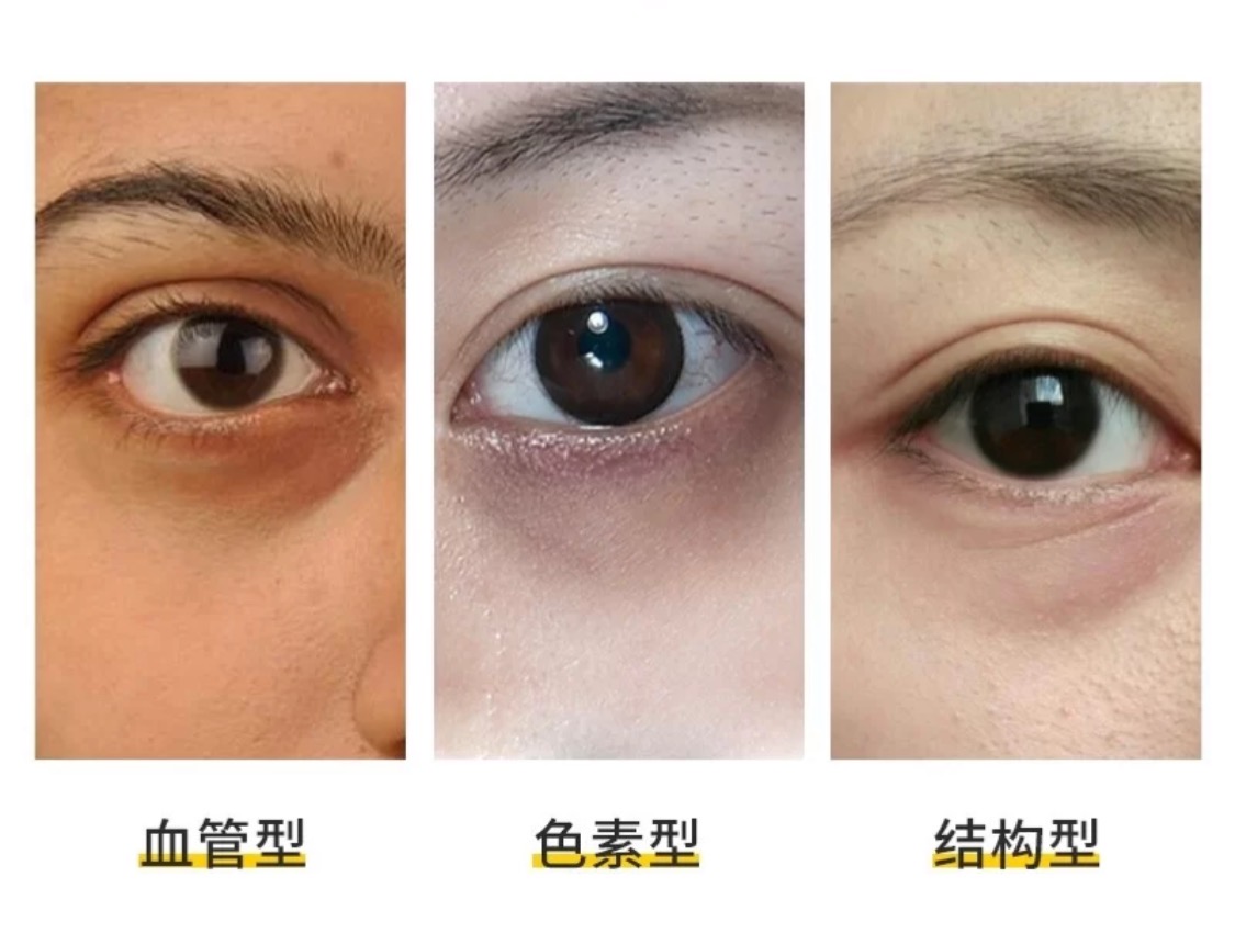 15秒了解眼睛有疾病,120秒轻松解决眼部问题