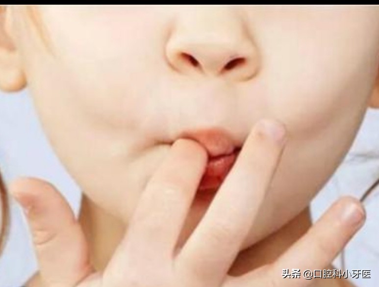 牙医的良心忠告牙齿矫正,别急着牙齿矫正先弄懂这10件事