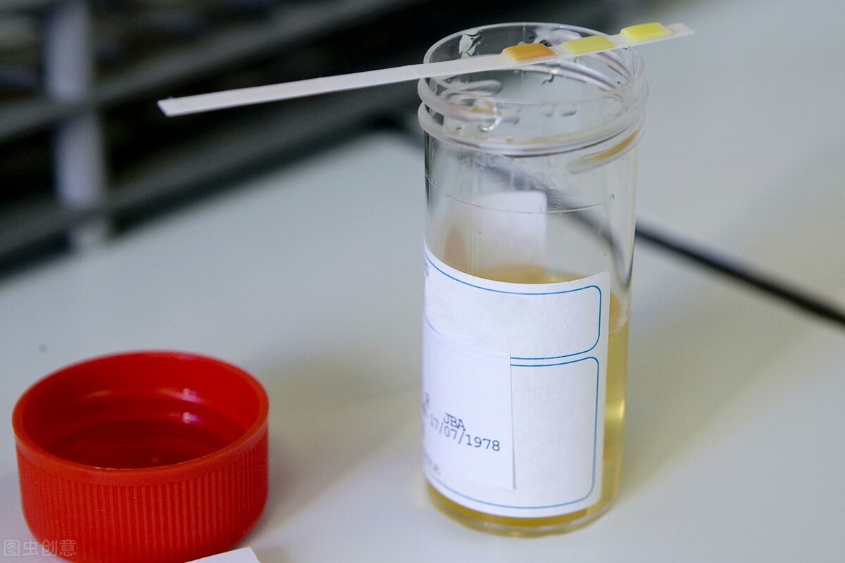 膀胱癌尿血是怎么造成的,膀胱癌尿血是怎样引起的