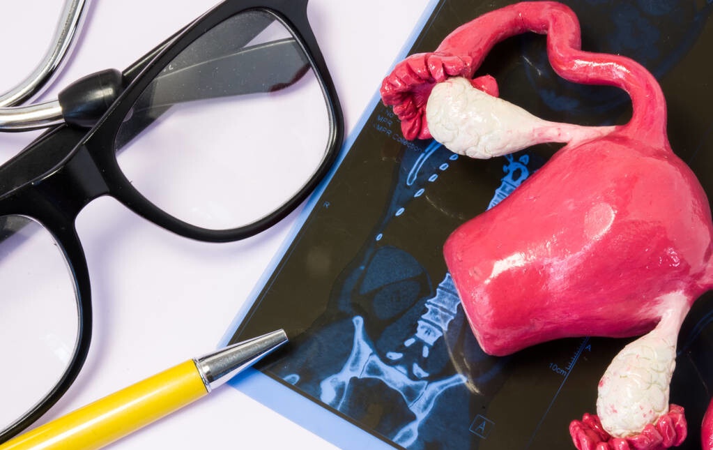 不疼不痒查出卵巢癌，很难理解？其实你身体早已发出了3个信号