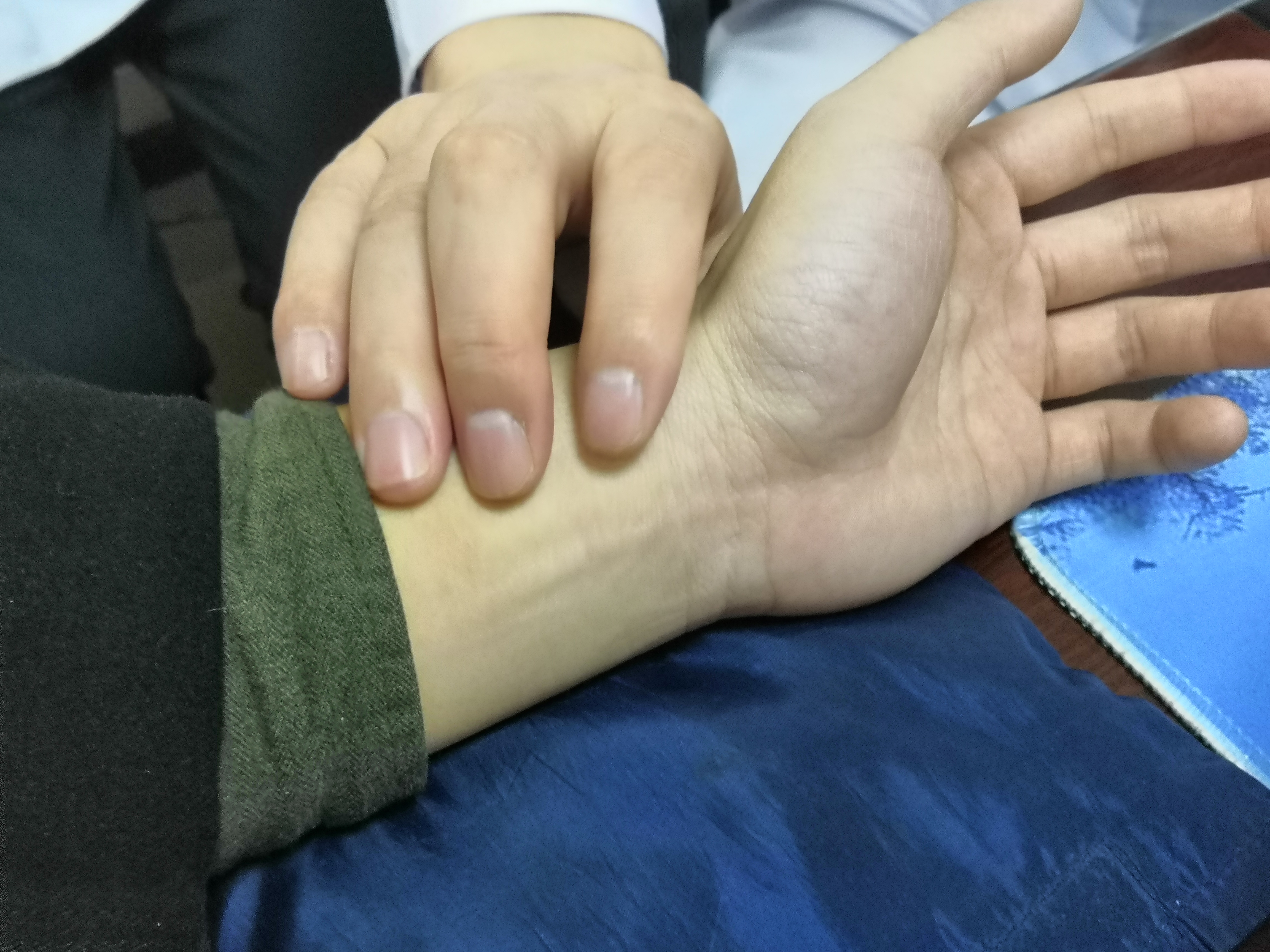 前列腺炎患者尿频能恢复正常吗,前列腺炎出现尿频症状多久能缓解